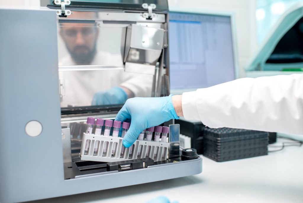 Laboratory assistant putting holder with test tubes into the analyzer machine. Close-up view focused on the tubes