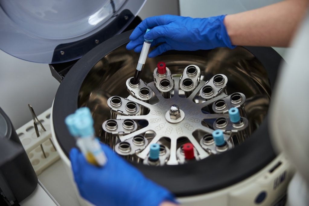 Cropped photo of female hands putting a test tube with a blood sample into a fixed-angle aluminum rotor